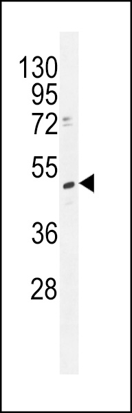 WB - TRMT2B Antibody (N-term) AP11166a