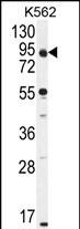 WB - KLRAQ1 Antibody (Center) AP11169c