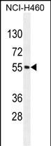 MIER2 Antibody (N-term) (Cat. #AP11173a) western blot analysis in NCI-H460 cell line lysates (35ug/lane).This demonstrates the MIER2 antibody detected the MIER2 protein (arrow).