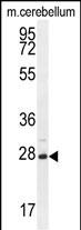 WB - VSTM2A Antibody (Center) AP11175c
