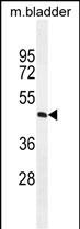 WB - PPAPDC1A Antibody (N-term) AP11185a