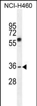 C10orf72 Antibody (Center) (Cat. #AP11192c) western blot analysis in NCI-H460 cell line lysates (35ug/lane).This demonstrates the C10orf72 antibody detected the C10orf72 protein (arrow).