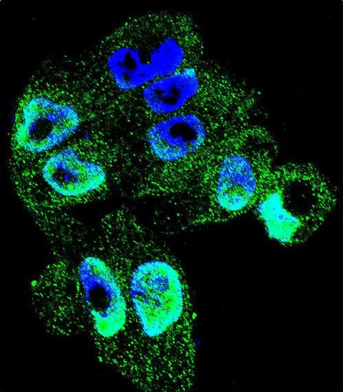 Confocal immunofluorescent analysis of TIMP1 Antibody (C-term)(Cat#AP11199b) with A2058 cell followed by Alexa Fluor 488-conjugated goat anti-rabbit lgG (green). DAPI was used to stain the cell nuclear (blue).