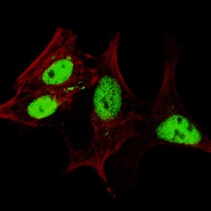 Fluorescent confocal image of SY5Y cells stained with AP11206c LIN28A (Center) antibody. SY5Y cells were fixed with 4% PFA (20 min), permeabilized with Triton X-100 (0.2%, 30 min), then incubated with AP11206c LIN28A (Center) primary antibody (1:200, 2 h at room temperature). For secondary antibody, Alexa Fluor� 488 conjugated donkey anti-rabbit antibody (green) was used (1:1000, 1h). Cytoplasmic actin was counterstained with Alexa Fluor� 555 (red) conjugated Phalloidin (5.25 ?M, 25 min). Lin28a immunoreactivity is localized very specifically to the nuclei of the SY5Y cells.
