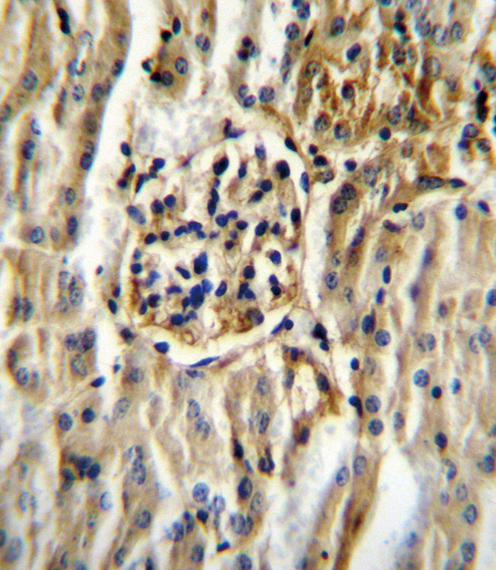 IHC-P - CYP11B2 Antibody (Center) AP11213C