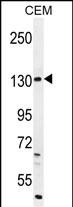 DUOX2 Antibody (Center) (Cat. #AP11227c) western blot analysis in CEM cell line lysates (35ug/lane).This demonstrates the DUOX2 antibody detected the DUOX2 protein (arrow).