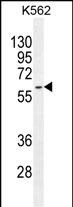 WB - KRT73 Antibody (C-term) AP11248b