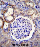 IHC-P - FA96A Antibody  (C-term) AP11250b