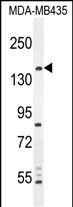 WB - CAMSAP1 Antibody (N-term) AP11271a
