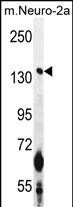 WB - CAMSAP1 Antibody (N-term) AP11271a