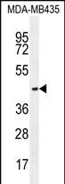 WB - OR2L13 Antibody (C-term) AP11273b