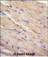 IHC-P - FAM69B Antibody (N-term) AP11279a