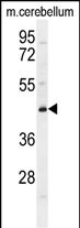 WB - CYB5D2 Antibody (C-term) AP11281b