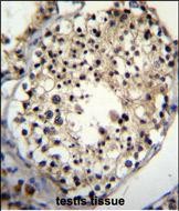 IHC-P - ALKBH6 Antibody (Center) AP11283c