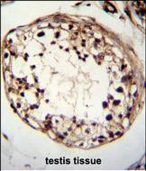IHC-P - TSPYL6 Antibody (Center) AP11292c