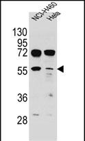 WB - TSPYL6 Antibody (Center) AP11292c
