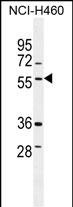 WB - TSNARE1 Antibody (C-term) AP11310b