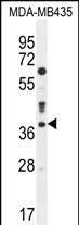 CASP3 Antibody (C-term) (Cat. #AP11324b) western blot analysis in MDA-MB435 cell line lysates (35ug/lane).This demonstrates the CASP3 antibody detected the CASP3 protein (arrow).