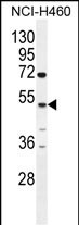 CPA6 Antibody (Center) (Cat. #AP11327c) western blot analysis in NCI-H460 cell line lysates (35ug/lane).This demonstrates the CPA6 antibody detected the CPA6 protein (arrow).