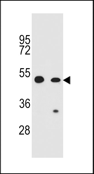 COP1 Antibody (N-term) (Cat. #AP11328a) western blot analysis in CEM,A549 cell line lysates (35ug/lane).This demonstrates the COP1 antibody detected the COP1 protein (arrow).
