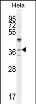WB - SELV Antibody (C-term) AP11340b