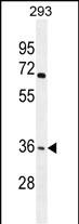WB - OR4F15 Antibody (N-term) AP11344a