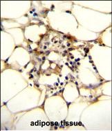 IHC-P - ZFTA Antibody (C-term) AP11349b
