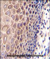 IHC-P - CCDC97 Antibody (C-term) AP11354b