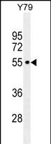 WB - CCDC97 Antibody (C-term) AP11354b