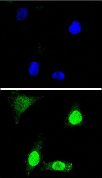 IF - WDR70 Antibody (C-term) AP11355B