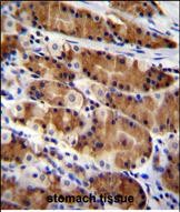 IHC-P - CCDC84 Antibody (N-term) AP11365a