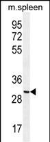 WB - CCDC84 Antibody (N-term) AP11365a