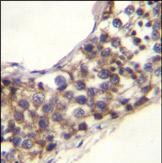 IHC-P - PNLDC1 Antibody (C-term) AP11385b