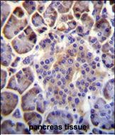 IHC-P - PTCHD4 Antibody (Center) AP11405c