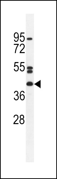 WB - NT5DC4 Antibody (Center) AP11408c