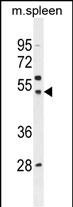 WB - SLC16A13 Antibody (C-term) AP11410b