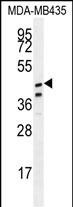 WB - SAMD7 Antibody (Center) AP11411c