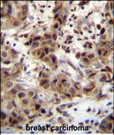 IHC-P - ZNF321 Antibody (N-term) AP11412a