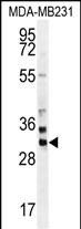 WB - ZNF321 Antibody (N-term) AP11412a