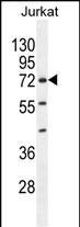 WB - ZNF648 Antibody (N-term) AP11416a