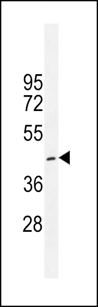 CRFR1 Antibody (Q103) (Cat. #AP11441a) western blot analysis in K562 cell line lysates (35ug/lane).This demonstrates the CRFR1 antibody detected the CRFR1 protein (arrow).