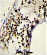 IHC-P - RACGAP1 Antibody (N-term) AP11461a