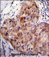 IHC-P - SCUBE2 Antibody (Center N266) AP11462c