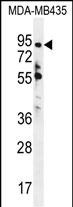WB - ZNF605 Antibody (N-term) AP11465a