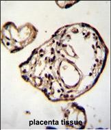 IHC-P - PM20D2 Antibody (C-term) AP11466b