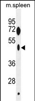 WB - ZNF385C Antibody (N-term) AP11482a
