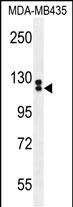 WB - TTLL13 Antibody (Center) AP11485c