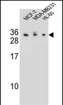 WB - C1QL4 Antibody (N-term) AP11512a