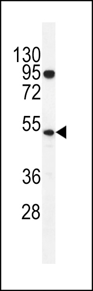 TdT Antibody (C-term) (Cat. #AP11561b) western blot analysis in K562 cell line lysates (35ug/lane).This demonstrates the TdT antibody detected the TdT protein (arrow).