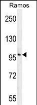 GUCY2D Antibody (Center) (Cat. #AP11569c) western blot analysis in Ramos cell line lysates (35ug/lane).This demonstrates the GUCY2D antibody detected the GUCY2D protein (arrow).